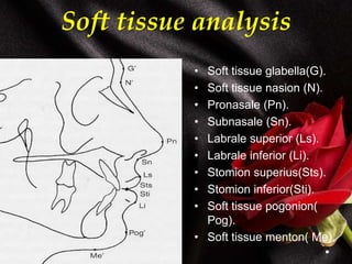 Soft tissue analysis
• Soft tissue glabella(G).
• Soft tissue nasion (N).
• Pronasale (Pn).
• Subnasale (Sn).
• Labrale superior (Ls).
• Labrale inferior (Li).
• Stomion superius(Sts).
• Stomion inferior(Sti).
• Soft tissue pogonion(
Pog).
• Soft tissue menton( Me).
 
