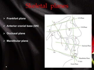 Skeletal planes
 Frankfort plane
 Anterior cranial base (SN)
 Occlusal plane
 Mandibular plane
 