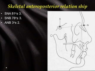 Skeletal anteroposterior relation ship
• SNA 81o± 3.
• SNB 78o± 3.
• ANB 3o± 2.
 