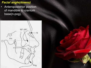 Facial angle(downs)
• Anteroposterior position
of mandible to cranium
base(n-pog).
 
