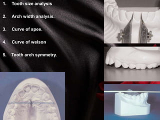 1. Tooth size analysis
2. Arch width analysis.
3. Curve of spee.
4. Curve of welson
5. Tooth arch symmetry.
 