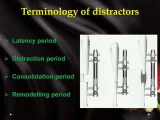 Terminology of distractors
 Latency period
 Distraction period
 Consolidation period
 Remodelling period
 