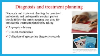 Diagnosis and treatment planning
Diagnosis and treatment planning for combined
orthodontic and orthognathic surgical patient
should follow the same sequence that used for
orthodontic treatment planning by taking
 Appropriate history
 Clinical examination
 Collection of appropriate diagnostic records
 