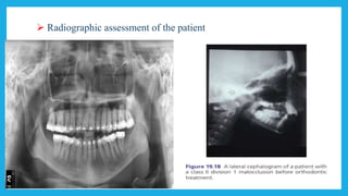  Radiographic assessment of the patient
 