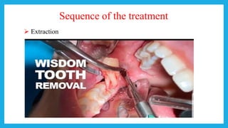 Sequence of the treatment
 Extraction
 