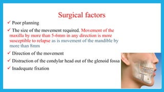 Surgical factors
 Poor planning
 The size of the movement required. Movement of the
maxilla by more than 5-6mm in any direction is more
susceptible to relapse as is movement of the mandible by
more than 8mm
 Direction of the movement
 Distraction of the condylar head out of the glenoid fossa
 Inadequate fixation
 