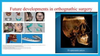 Future developments in orthognathic surgery
 