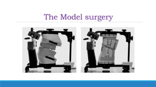The Model surgery
 