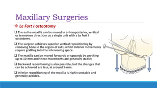 Maxillary Surgeries
 Le Fort I osteotomy
 The entire maxilla can be moved in anteroposterior, vertical
or transverse directions as a single unit with a Le Fort I
osteotomy.
 The surgeon achieves superior vertical repositioning by
removing bone in the region of cuts, whilst inferior movements
require grafting into the intervening space.
 The maxilla can be moved forwards or upwards by anything
up to 10-mm and these movements are generally stable;
 Backward repositioning is also possible, but the changes that
can be achieved are less, at around 5-mm.
 Inferior repositioning of the maxilla is highly unstable and
generally avoided.
 