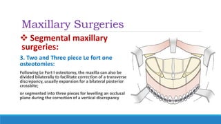 Maxillary Surgeries
 Segmental maxillary
surgeries:
3. Two and Three piece Le fort one
osteotomies:
Following Le Fort I osteotomy, the maxilla can also be
divided bilaterally to facilitate correction of a transverse
discrepancy, usually expansion for a bilateral posterior
crossbite;
or segmented into three pieces for levelling an occlusal
plane during the correction of a vertical discrepancy
 