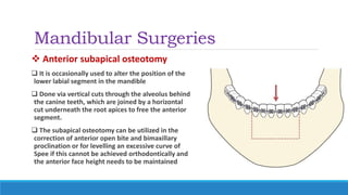Mandibular Surgeries
 Anterior subapical osteotomy
 It is occasionally used to alter the position of the
lower labial segment in the mandible
 Done via vertical cuts through the alveolus behind
the canine teeth, which are joined by a horizontal
cut underneath the root apices to free the anterior
segment.
 The subapical osteotomy can be utilized in the
correction of anterior open bite and bimaxillary
proclination or for levelling an excessive curve of
Spee if this cannot be achieved orthodontically and
the anterior face height needs to be maintained
 