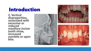 Introduction
2. Vertical
disproportion,
associated with
excessive or
reduced
maxillary incisor
tooth show,
increased
overbite or open
bite.
 