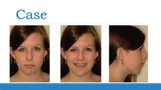 Case
 