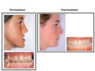 Pre-treatment Post-treatment
 