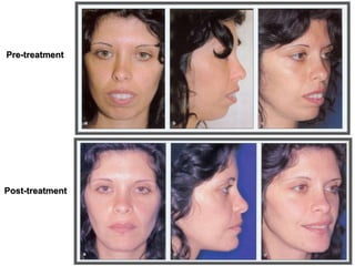 Pre-treatment
Post-treatment
 