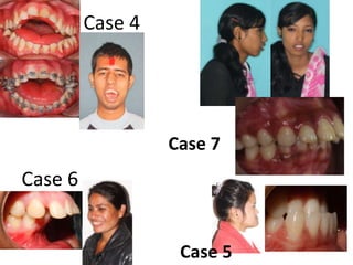 Case 4

Case 7

Case 6
Case 5

 