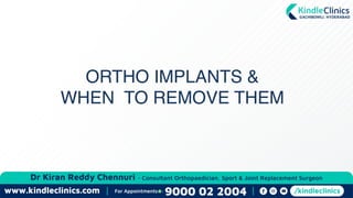 ORTHO IMPLANTS &
WHEN TO REMOVE THEM
 