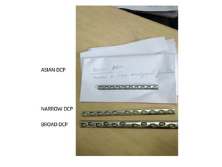 ASIAN DCP
NARROW DCP
BROAD DCP
 