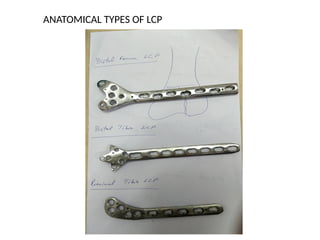 ANATOMICAL TYPES OF LCP
 