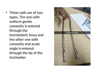• These nails are of two
types. The one with
uniform gentle
convexity is entered
through the
trochanteric fossa and
the other one with
convexity and acute
angle is entered
through the tip of the
trochanter.
 