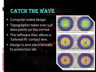 Catch the WAVEComputer aided designTopographer takes over 14K data points on the corneaThe software then allows a ‘tailored fit’ contact lensDesign is sent electronically to production lab