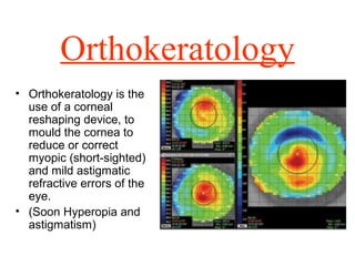 Orthokeratology
• Orthokeratology is the
use of a corneal
reshaping device, to
mould the cornea to
reduce or correct
myopic (short-sighted)
and mild astigmatic
refractive errors of the
eye.
• (Soon Hyperopia and
astigmatism)
 
