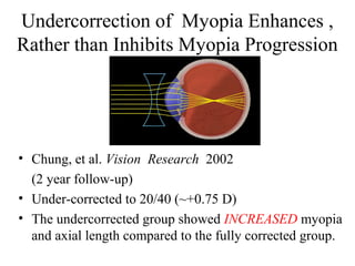 Undercorrection of Myopia Enhances ,
Rather than Inhibits Myopia Progression
• Chung, et al. Vision Research 2002
(2 year follow-up)
• Under-corrected to 20/40 (~+0.75 D)
• The undercorrected group showed INCREASED myopia
and axial length compared to the fully corrected group.
 