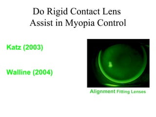 Do Rigid Contact Lens
Assist in Myopia Control
Katz (2003)
Am J Ophthalmology
Walline (2004)
Arch of Ophthalmology
Alignment Fitting Lenses
 