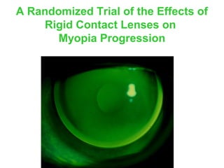 A Randomized Trial of the Effects of
Rigid Contact Lenses on
Myopia Progression
 