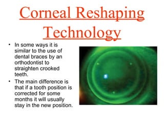 Corneal Reshaping
Technology
• In some ways it is
similar to the use of
dental braces by an
orthodontist to
straighten crooked
teeth.
• The main difference is
that if a tooth position is
corrected for some
months it will usually
stay in the new position.
 