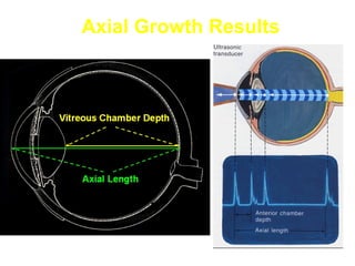 Axial Growth Results
 