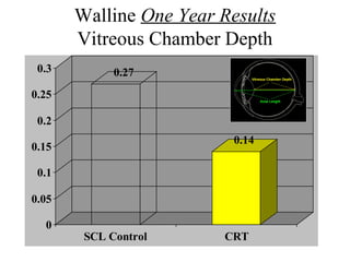 Walline One Year Results
Vitreous Chamber Depth
0.27
0.14
0
0.05
0.1
0.15
0.2
0.25
0.3
SCL Control CRT
 