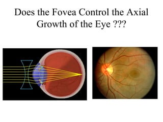 Does the Fovea Control the Axial
Growth of the Eye ???
Earl Smith et.al. University of Houston
 