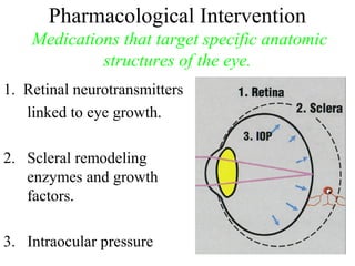 Pharmacological Intervention
Medications that target specific anatomic
structures of the eye.
1. Retinal neurotransmitters
linked to eye growth.
2. Scleral remodeling
enzymes and growth
factors.
3. Intraocular pressure
 