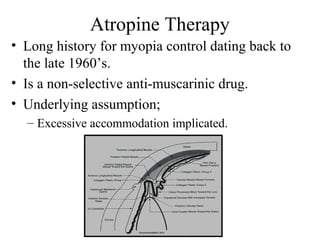 Atropine Therapy
• Long history for myopia control dating back to
the late 1960’s.
• Is a non-selective anti-muscarinic drug.
• Underlying assumption;
– Excessive accommodation implicated.
 