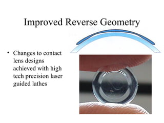 Improved Reverse Geometry
• Changes to contact
lens designs
achieved with high
tech precision laser
guided lathes
 