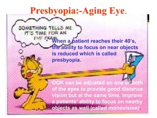 Presbyopia:-Aging Eye.
• When a patient reaches their 40’s,
the ability to focus on near objects
is reduced which is called
presbyopia.
• OOK can be adjusted on one or both
of the eyes to provide good distance
vision but at the same time, improve
a patients’ ability to focus on nearby
objects as well (called monovision).
 