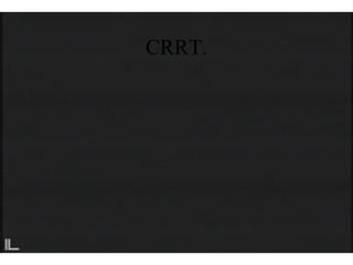 CRRT.
 