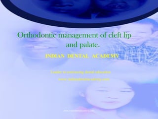 1
Orthodontic management of cleft lip
and palate.
INDIAN DENTAL ACADEMY
Leader in continuing dental education
www.indiandentalacademy.com
www.indiandentalacademy.com
 