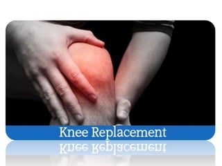 Orthopaedic