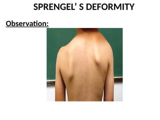 Spangles Defect Orthopaedic assessment of_pediatric_conditions | PDF