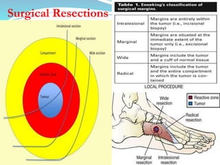 Orthopaedic oncology | PPTX