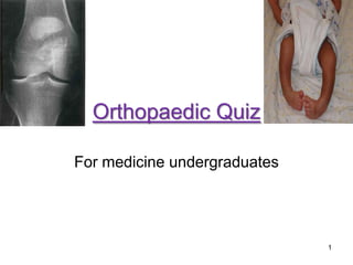 Orthopaedic Quiz

For medicine undergraduates




                              1
 