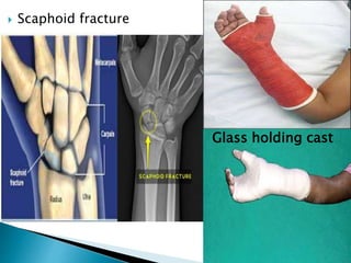 Orthopaedics | PPT
