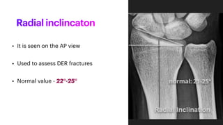 Orthopaedics - Distal End Radius fractures.pdf