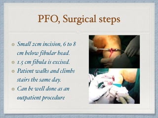 PFO, Surgical steps
Small 2cm incision, 6 to 8
cm below fibular head.
1.5 cm fibula is excised.
Patient walks and climbs
stairs the same day.
Can be well done as an
outpatient procedure
 