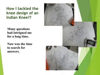 How I tackled the
knee design of an
Indian Knee??
Many questions
had intrigued me
for a long time.
Now was the time
to search for
answers.
 
