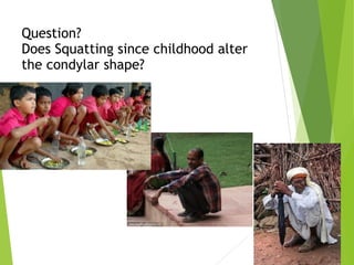 Question? 
Does Squatting since childhood alter
the condylar shape?
 