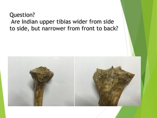 Question? 
Are Indian upper tibias wider from side
to side, but narrower from front to back?
 