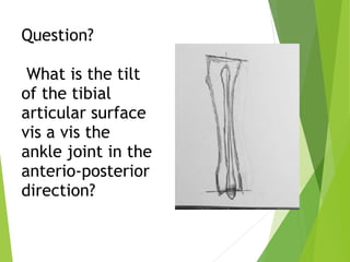 Question? 
 
What is the tilt
of the tibial
articular surface
vis a vis the
ankle joint in the
anterio-posterior
direction?
 